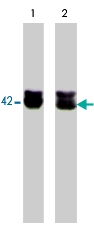 PAB7880 - Actin beta / ACTB