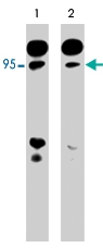 PAB7881 - B-Raf proto-oncogene