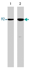 PAB7883 - Catenin beta-1