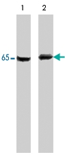 PAB7885 - PDPK1