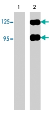 PAB7886 - SEMA3A
