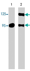 PAB7888 - SEMA3A