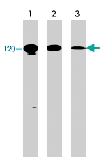 PAB7893 - CD324 / Cadherin-1