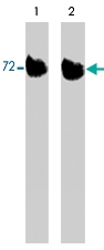 PAB7894 - LIMK1