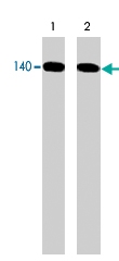PAB7895 - NOS3