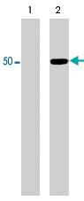PAB7903 - TUBB3 / TUBB4
