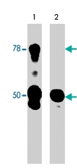 PAB7906 - WASF1 / WAVE1