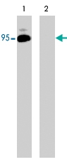 PAB7907 - B-Raf proto-oncogene