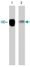 PAB7911 - EGFR / ERBB1