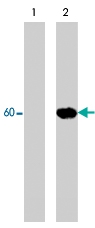 PAB7912 - AKT1 / PKB