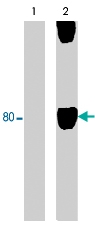 PAB7913 - WASF1 / WAVE1