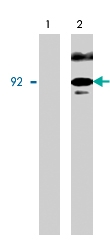 PAB7914 - Catenin beta-1