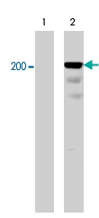 PAB7916 - CD104 / Integrin beta-4