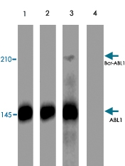 PAB7918 - ABL1
