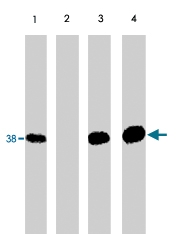 PAB7919 - NFKBIA / IKBA