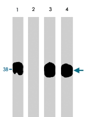 PAB7922 - NFKBIA / IKBA