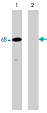 PAB7923 - PTPN6