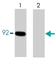 PAB7925 - Catenin beta-1