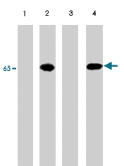 PAB7926 - PDPK1