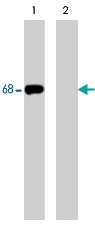 PAB7927 - PTPN6