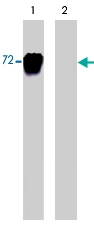 PAB7928 - LIMK1