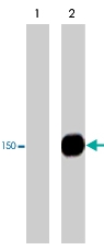 PAB7929 - PLCG1