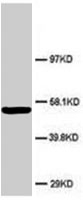 PAB7947 - ABI1 / SSH3BP1