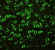 PAB7947 - ABI1 / SSH3BP1