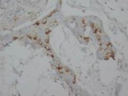 PAB7957 - Calretinin