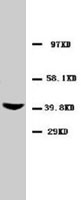 PAB7958 - CD195 / CCR5