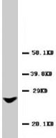 PAB7965 - GJB2 / Cx26