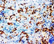 PAB7967 - Cyclooxygenase 1