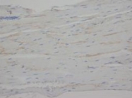 PAB7968 - C-reactive protein (CRP)