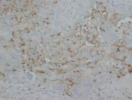 PAB7969 - CD182 / IL8RB