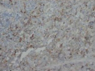 PAB7973 - FGF4