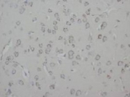 PAB7977 - GAP43