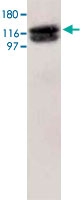 PAB7981 - HIF1A / HIF1 alpha