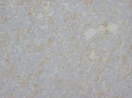 PAB7988 - Myelin Basic Protein