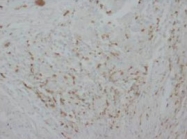 PAB7992 - Myeloperoxidase