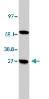 PAB7995 - NIP3