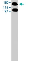 PAB7997 - NMDAR2B