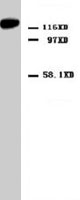 PAB7998 - Reticulon-4 / RTN4