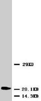 PAB7999 - Neuron specific enolase