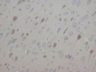 PAB8000 - Neurotrophin 3 / NTF3