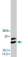 PAB8004 - Placenta growth factor / PGF
