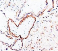 PAB8004 - Placenta growth factor / PGF