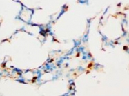 PAB8011 - SOCS1