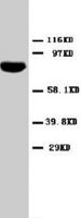 PAB8012 - STAT1