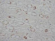 PAB8012 - STAT1