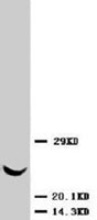 PAB8014 - TIMP3
